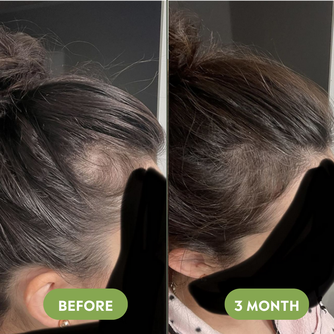 Vitalis Hair Growth Oil – For Thicker, Fuller-Looking Hair