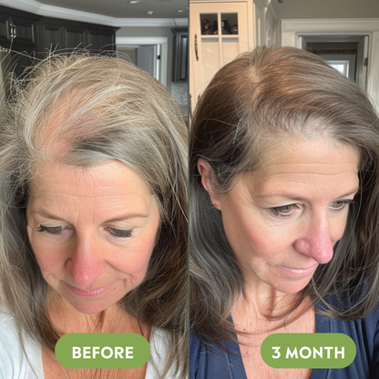 Vitalis Hair Growth Oil – For Thicker, Fuller-Looking Hair