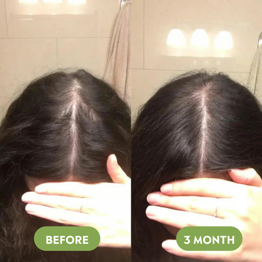 Vitalis Hair Growth Oil – For Thicker, Fuller-Looking Hair