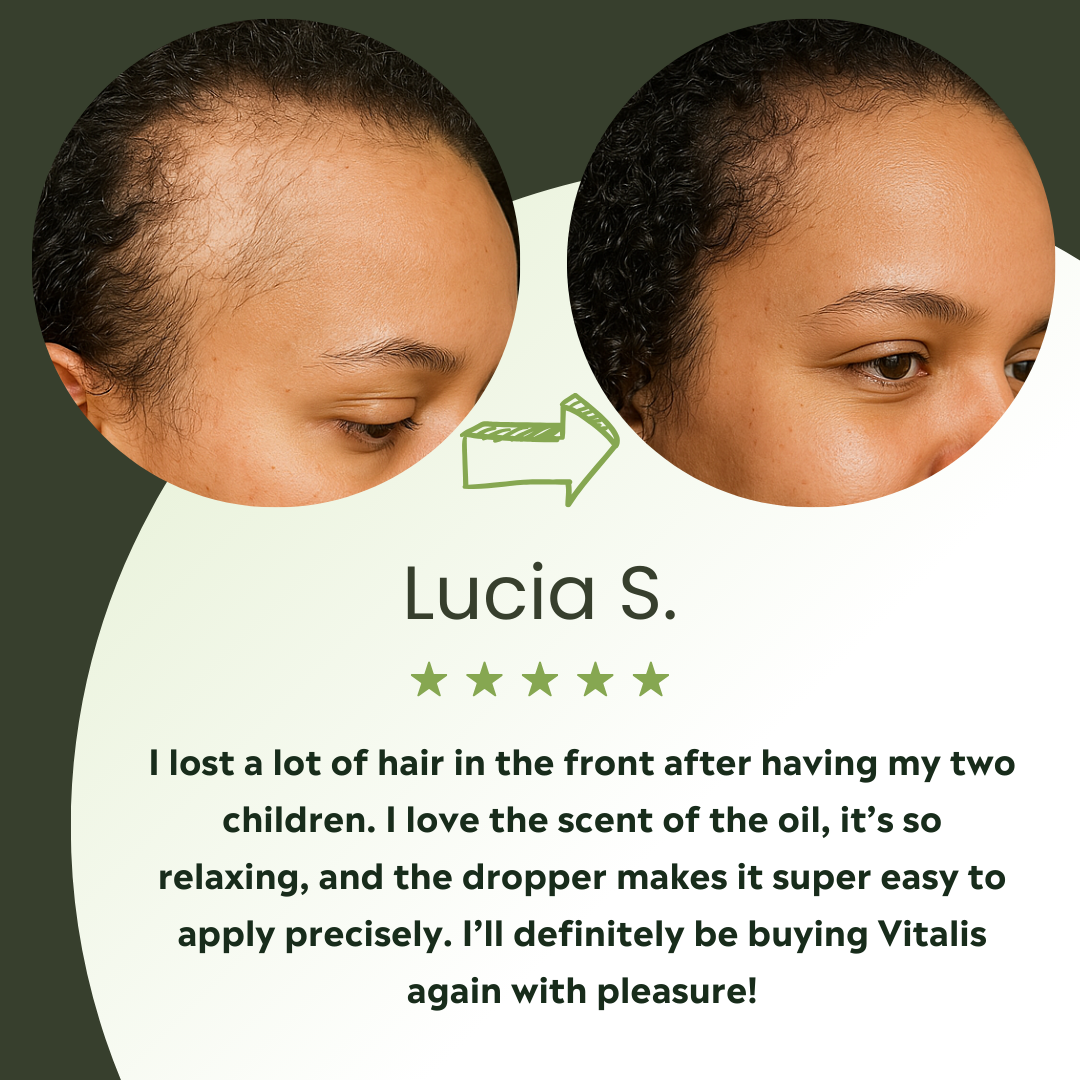 Vitalis Hair Growth Oil – For Thicker, Fuller-Looking Hair