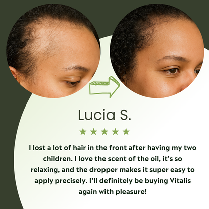 Vitalis Hair Growth Oil – For Thicker, Fuller-Looking Hair