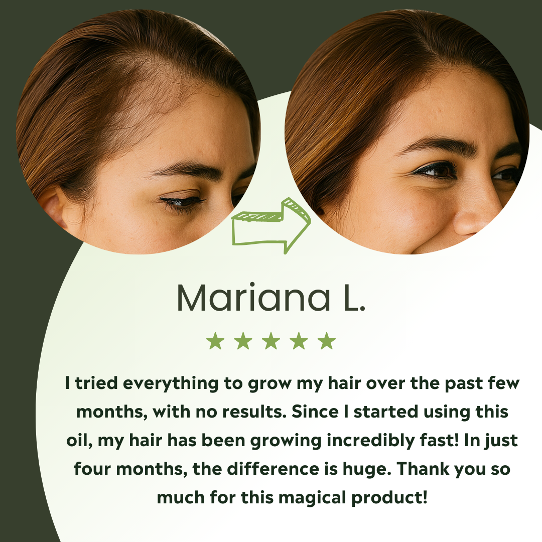 Vitalis Hair Growth Oil – For Thicker, Fuller-Looking Hair