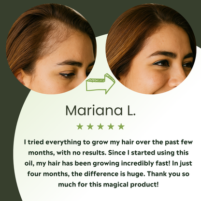 Vitalis Hair Growth Oil – For Thicker, Fuller-Looking Hair